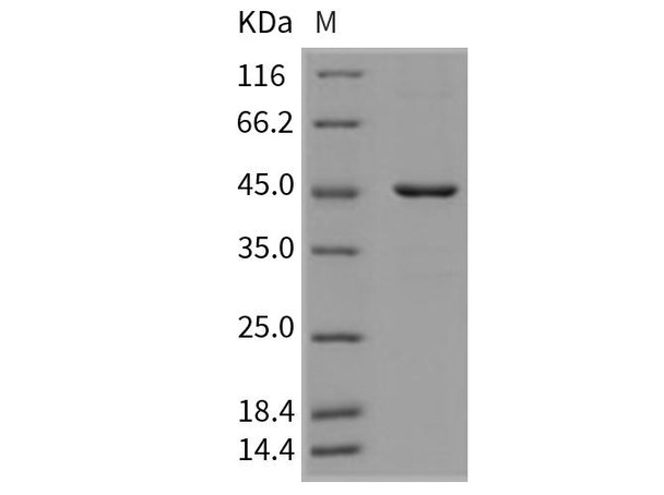 Mouse HDAC8/HDACL1 Recombinant Protein (His Tag) (RPES3279)