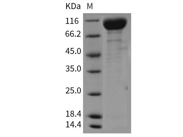 Mouse VEGFR2/Flk/KDR Recombinant Protein (His Tag) (RPES3298)