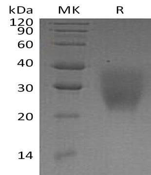 Human LRRC25 Recombinant Protein (RPES3304)