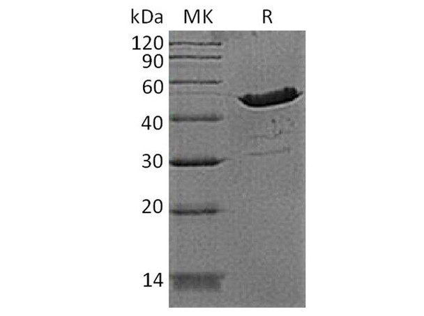 Human Creatine Kinase BB/CKB Recombinant Protein (RPES3312)