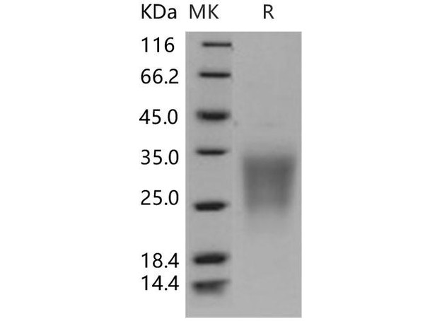 Human SIGIRR/TIR8 Recombinant Protein (RPES3314)
