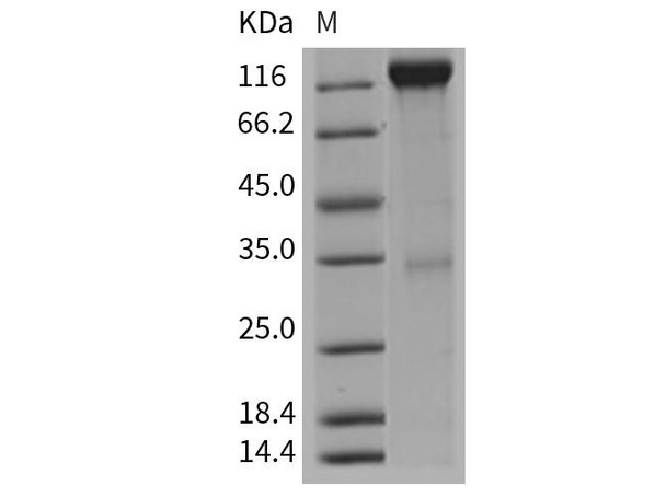 Mouse VEGFR2/Flk/KDR Recombinant Protein (Fc Tag) (Active) (RPES3318)