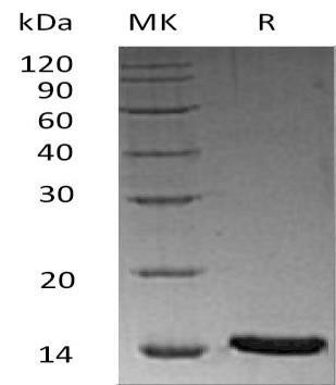 Human LRRC3B Recombinant Protein (RPES3324)