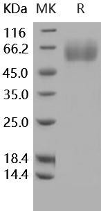 Human MSR1/SCARA1/CD204 Recombinant Protein (His Tag) (RPES3337)