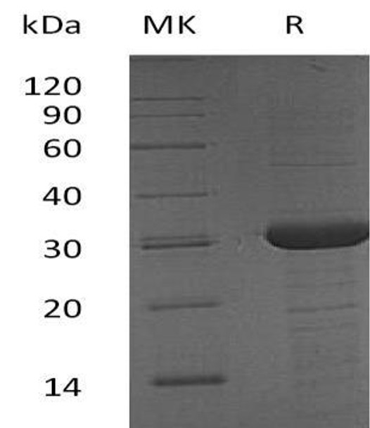 Human BCAS2/DAM1 Recombinant Protein (RPES3343)