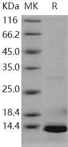 Human S100A5 Recombinant Protein (His Tag) (RPES3355)