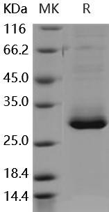 Human RAB27B Recombinant Protein (His Tag) (RPES3374)