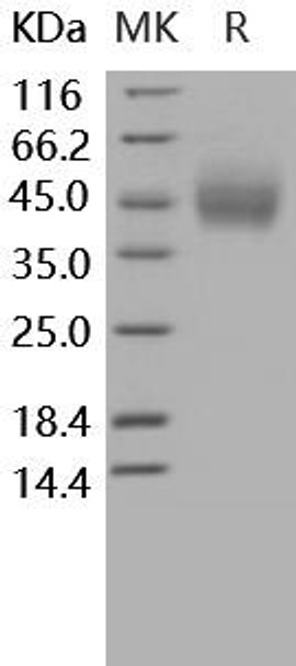 Human CD89/FCAR Recombinant Protein (His Tag) (Active) (RPES3376)