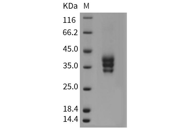 Mouse ESAM Recombinant Protein (His Tag) (RPES3378)