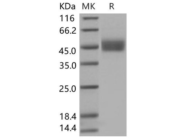 Human FSTL1 Recombinant Protein (His Tag) (RPES3380)