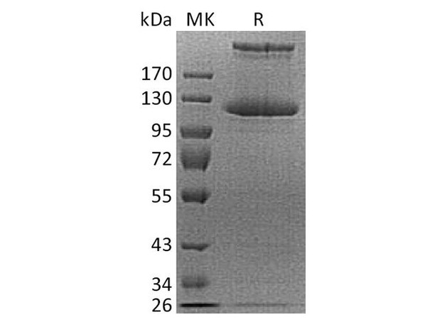 Human COL21A1 Recombinant Protein (RPES3391)