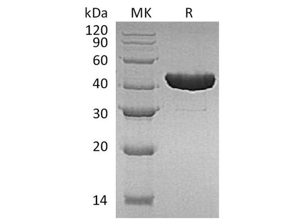 E.coli Trp B Recombinant Protein (RPES3392)