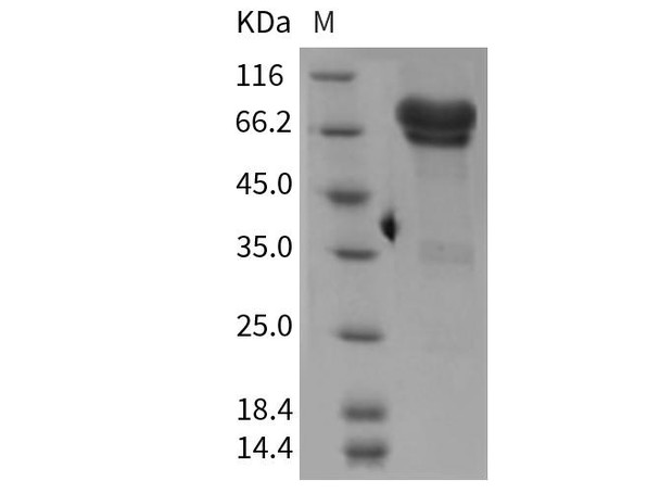 Mouse NGFR/CD271 Recombinant Protein (Fc Tag) (Active) (RPES3417)