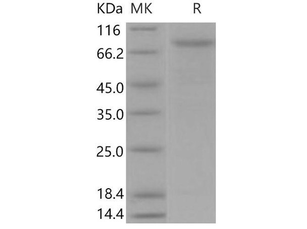 Mouse VE-Cadherin/CDH5 Recombinant Protein (His Tag) (RPES3425)