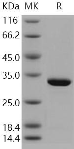 Carbonic Anhydrase 7/CA7 Recombinant Protein (RPES3433)
