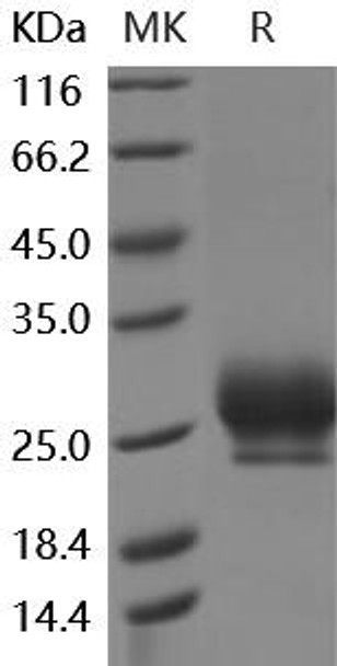 Human RNF43 Recombinant Protein (His Tag) (RPES3438)