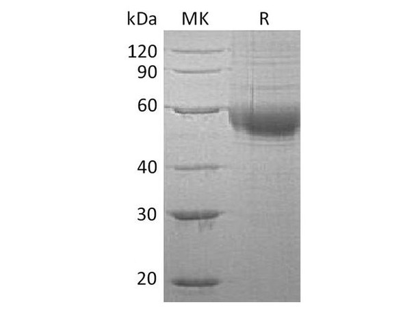 Human PLA2G7/Lp-PLA2 Recombinant Protein (RPES3449)