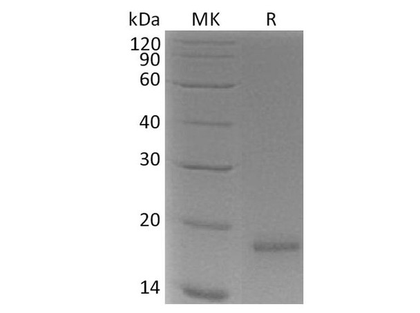 Human CLDN18.1 /CLDN18 Recombinant Protein (RPES3451)