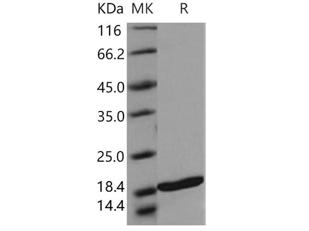 Human TRAIL Recombinant Protein (RPES3456)
