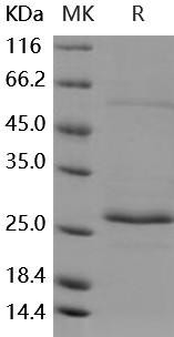 Human RAB27B Recombinant Protein (RPES3460)