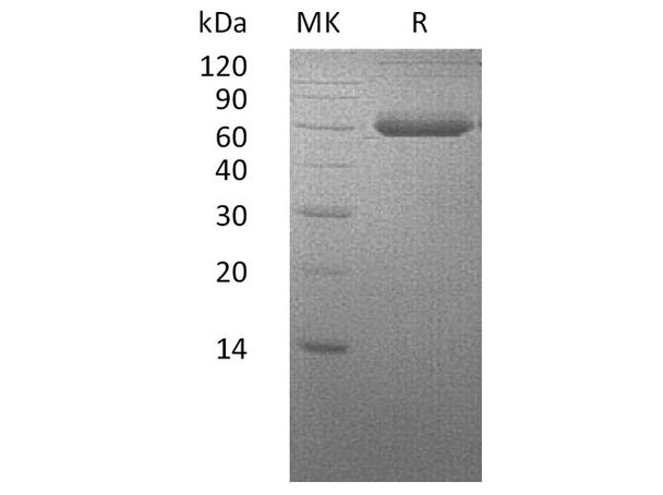 Human BMPRIA/ALK-3 Recombinant Protein (RPES3483)