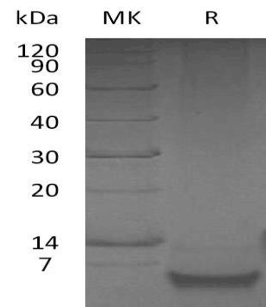 Human Beta-Defensin 1/DEFB1 Recombinant Protein (RPES3487)