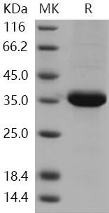Human ACBD6 Recombinant Protein (RPES3497)