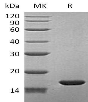 Human BLBP/FABP7 Recombinant Protein (RPES3504)