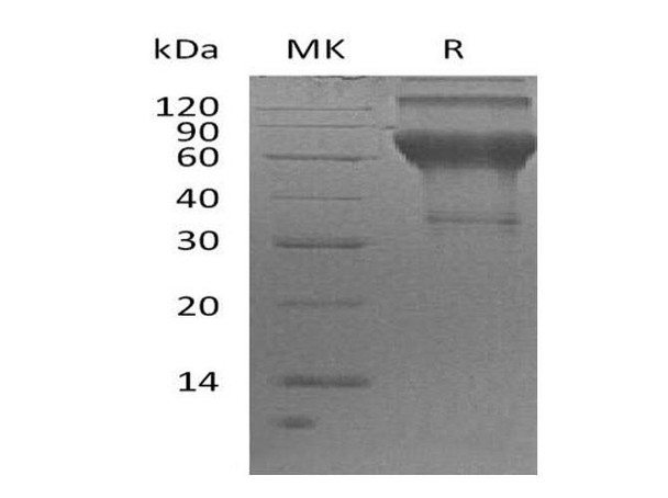 Human LMIR2/CD300C Recombinant Protein (RPES3526)