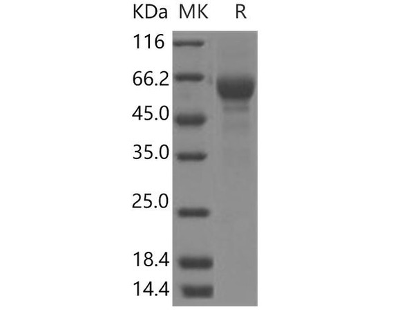 Human TRAP-alpha/SSR1 Recombinant Protein (Fc Tag) (RPES3542)
