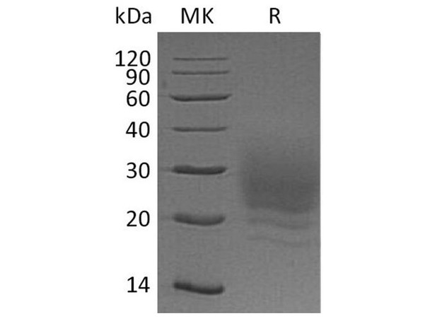 Human BOC Recombinant Protein (RPES3544)