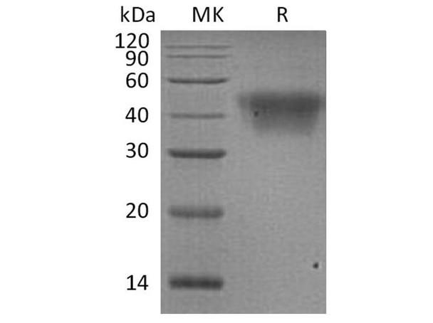 Human CD16a/FCGR3A Recombinant Protein (RPES3567)