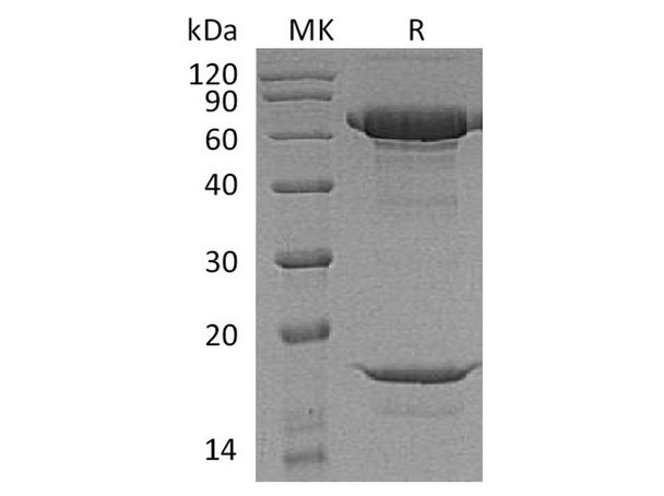 Macaca nemestrina PCSK9 Recombinant Protein (RPES3577)