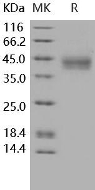 Human IL-20RA/IL-20R1 Recombinant Protein (His Tag) (RPES3601)