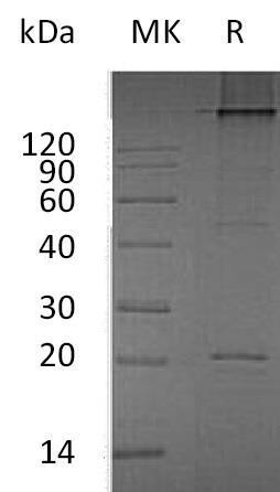 Human RANKL/TNFSF11 Recombinant Protein (His Tag) (Active) (RPES3610)