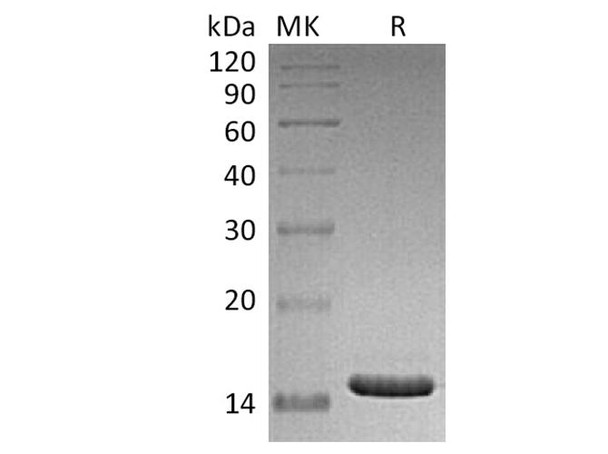 Human CD40L/TNFSF5 Recombinant Protein (E.coli) (Active) (RPES3661)