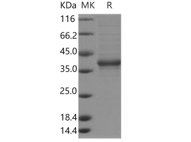 Human FAM150A Recombinant Protein (Fc Tag) (RPES3663)