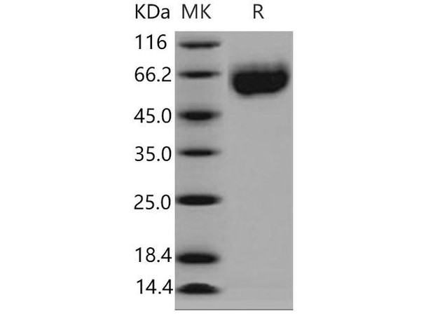Mouse Axl Kinase Recombinant Protein (His Tag) (RPES3699)