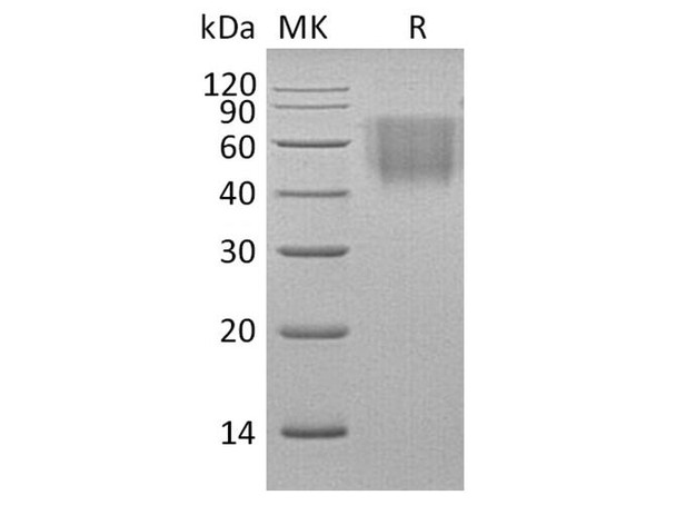 Rhesus macaque B7-2/CD86 Recombinant Protein (RPES3706)