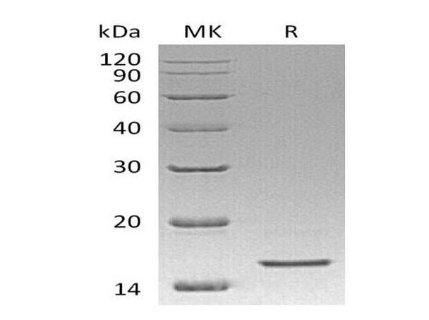 Human REG4/RELP Recombinant Protein (RPES3718)