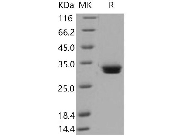 Mouse MCPT1 Recombinant Protein (RPES3755)