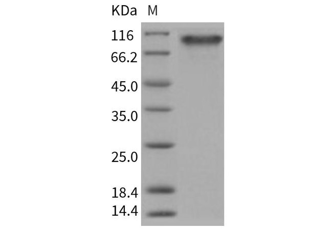 Human PDGFRa/CD140a Recombinant Protein (His Tag) (Active) (RPES3757)