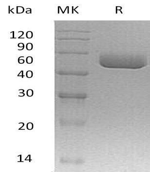 Mouse Serpina1c Recombinant Protein (RPES3764)
