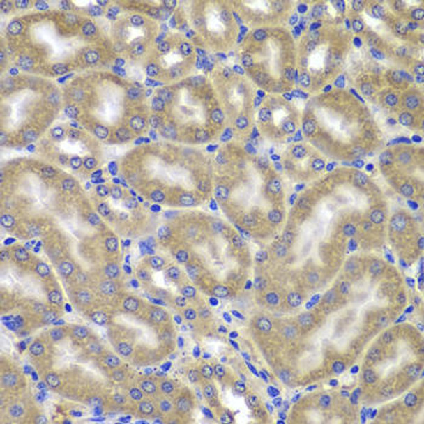 Anti-NLRC4 Antibody (CAB7382)