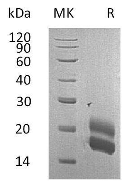 Rat GM-CSF/CSF2 Recombinant Protein (RPES3805)