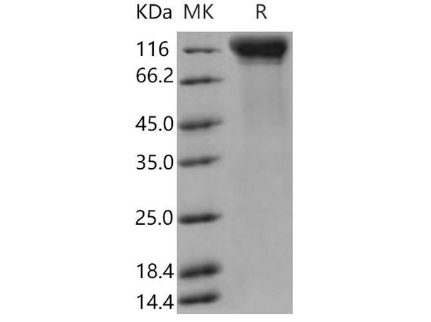Mouse IL12RB2/IL12R-beta 2 Recombinant Protein (His Tag) (Active) (RPES3806)