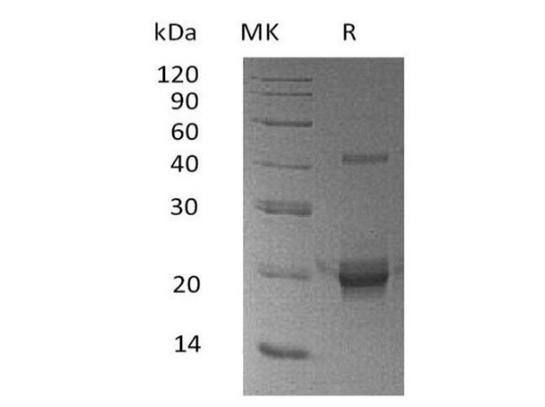 Human DUSP3/VHR Recombinant Protein (RPES3811)