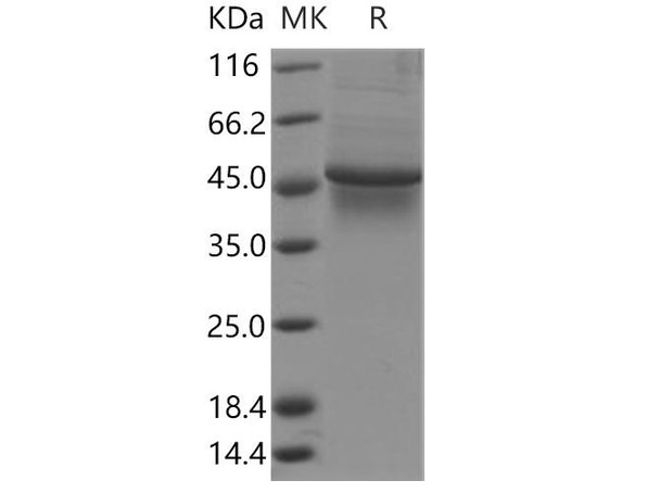 Human TAPBP/ Tapasin Recombinant Protein (His Tag) (RPES3835)