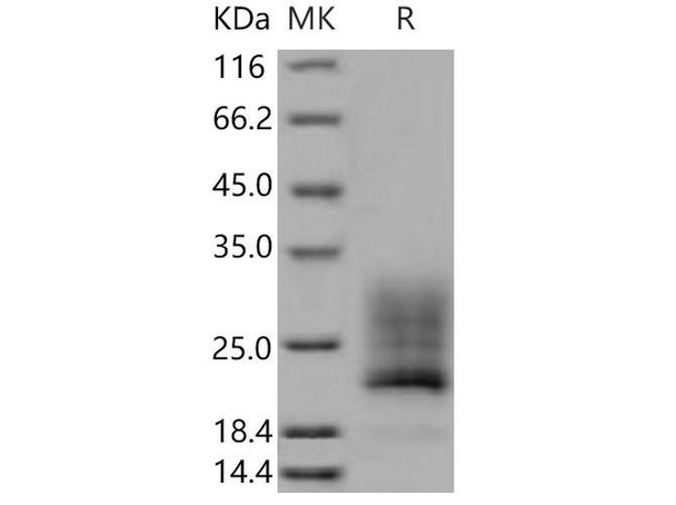 Mouse REG4/RELP Recombinant Protein (His Tag) (Active) (RPES3885)