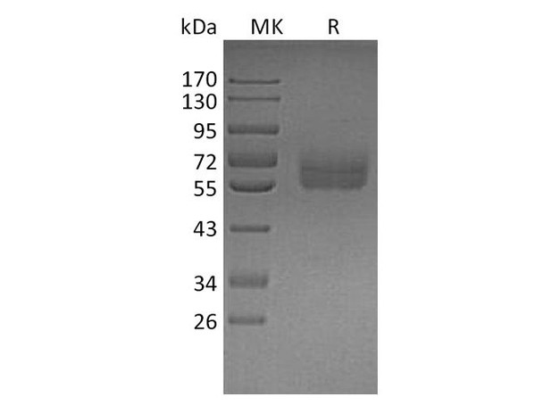 Human TYRO3 Recombinant Protein (RPES3898)
